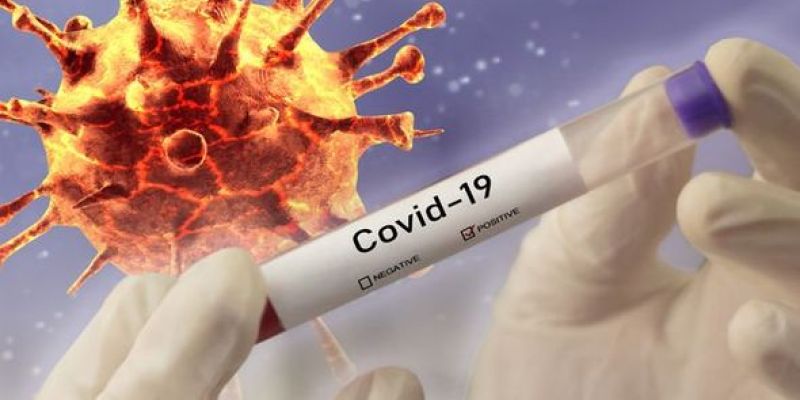 Covid-19 – estamos atendendo em home office